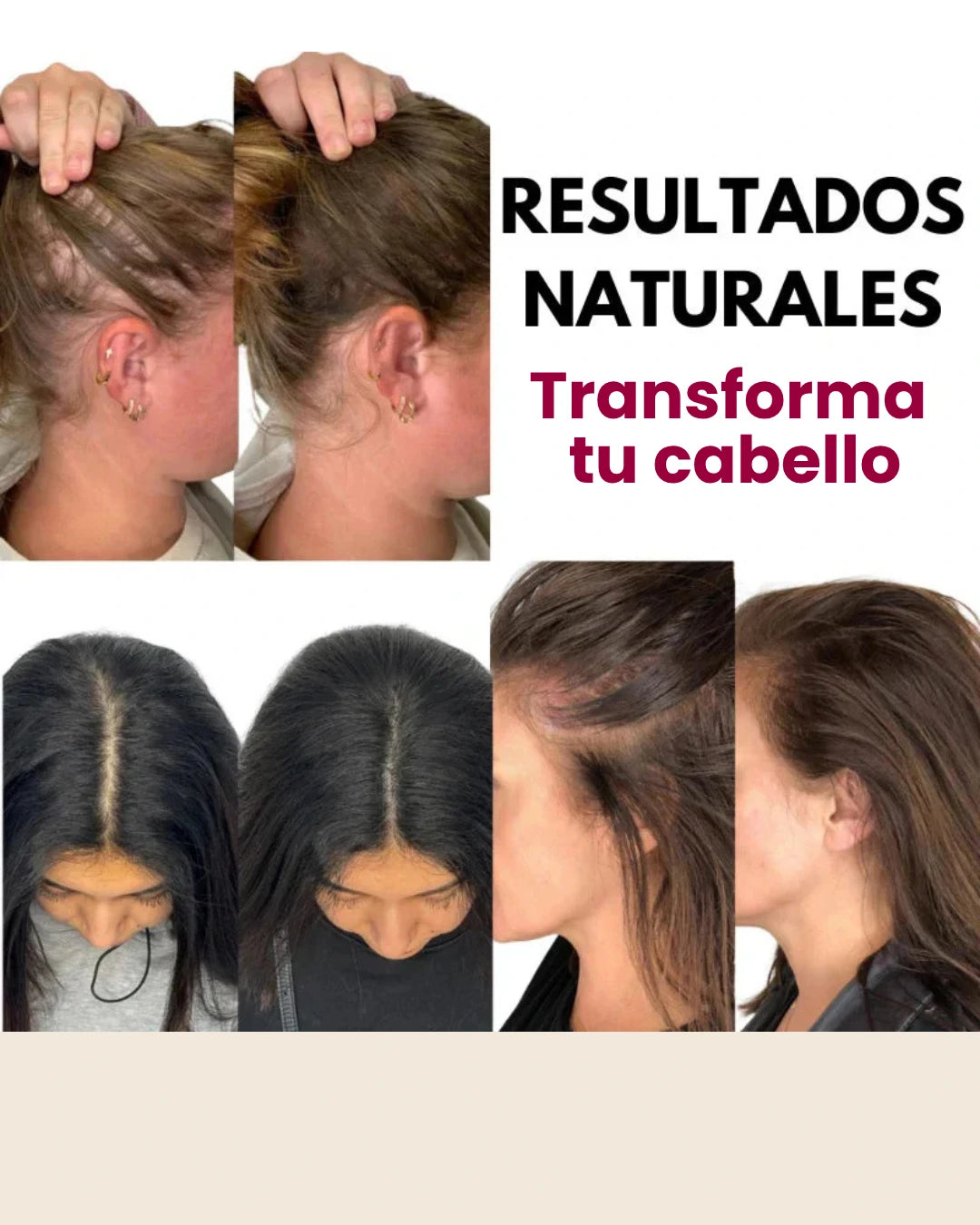 Hairlux™ | Rutina anticaída con luz y aceite reparador