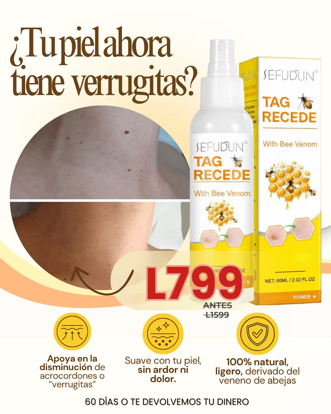 Tag Recede™- Spray eliminador de verrugas
