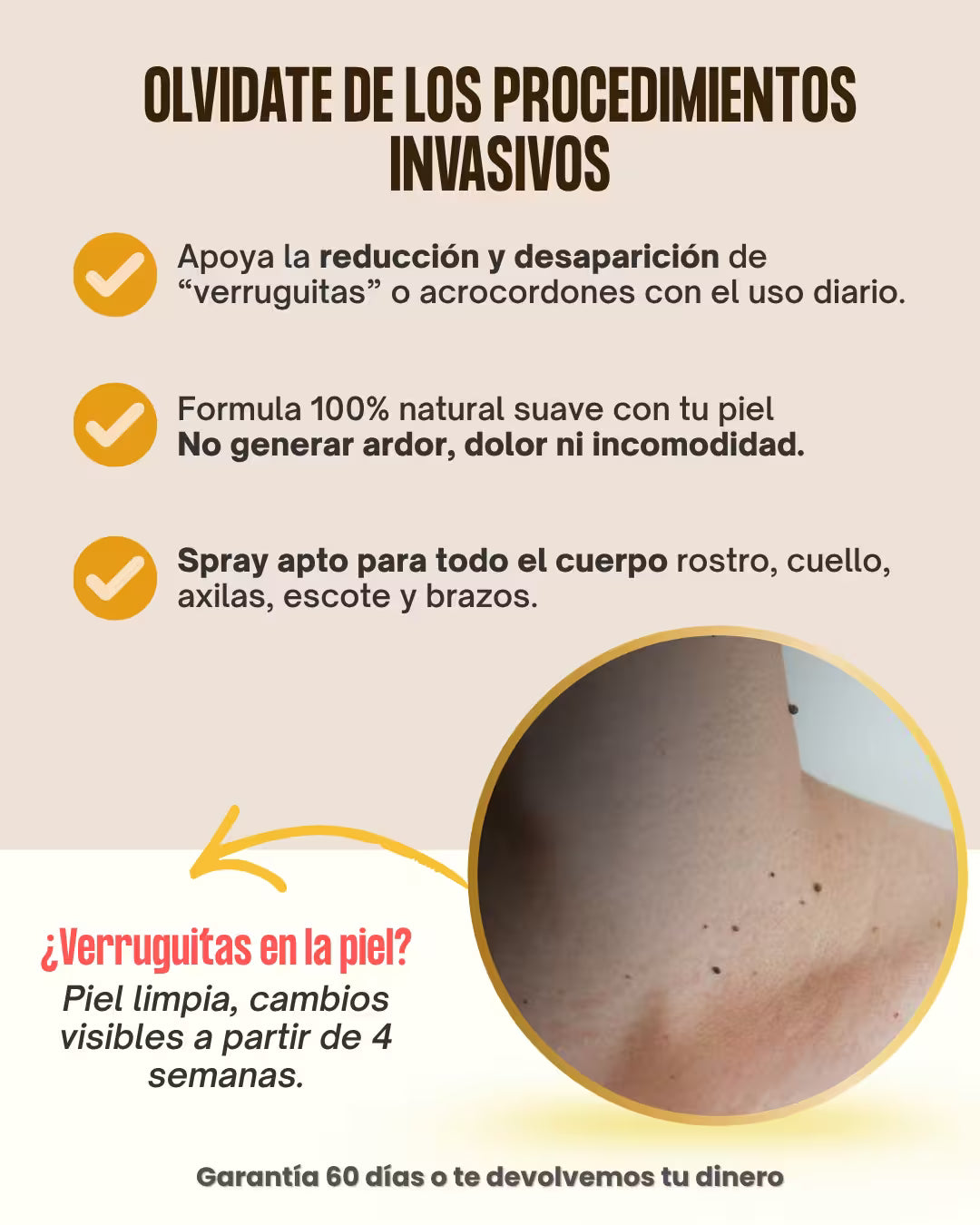 Tag Recede™- Spray eliminador de verrugas